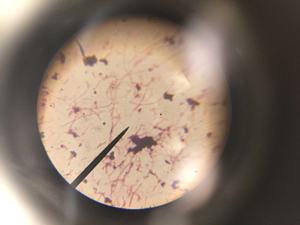 Macy Gault"s bacteria through microscope 