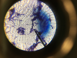 Sarah Fowlers bacteria through microscope 